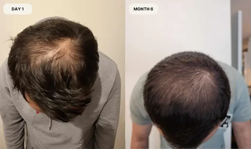 Phil's progress